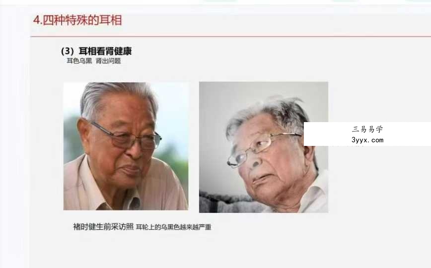 《面相学细微对比图示》286页 资料图片