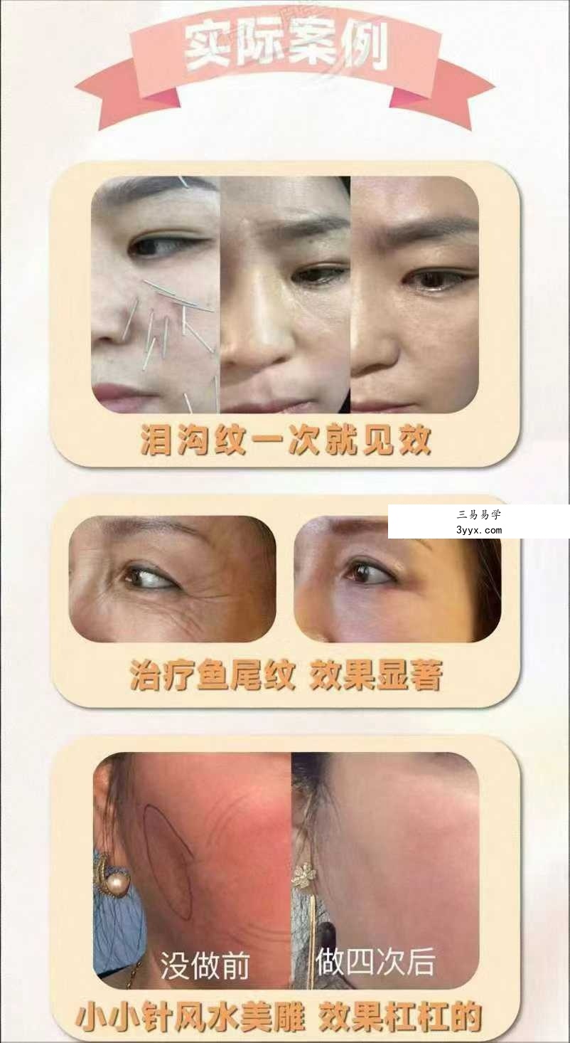 刘梅 2024年12月份《小小针面部风水美雕面授课》38集视频课 资料图片