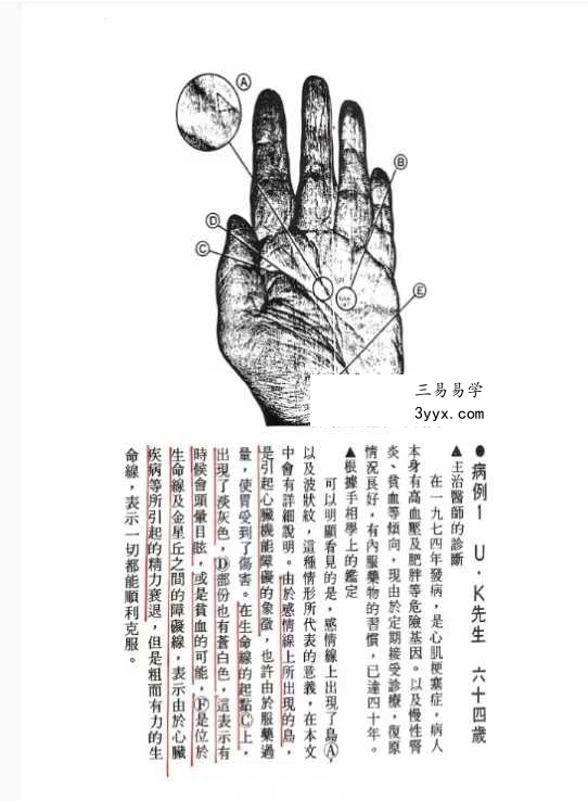 《由手相看健康》209页 资料图片