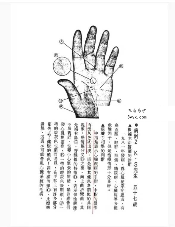 《由手相看健康》209页 资料图片
