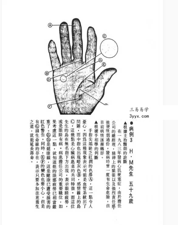 《由手相看健康》209页 资料图片