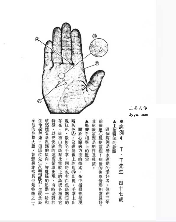 《由手相看健康》209页 资料图片