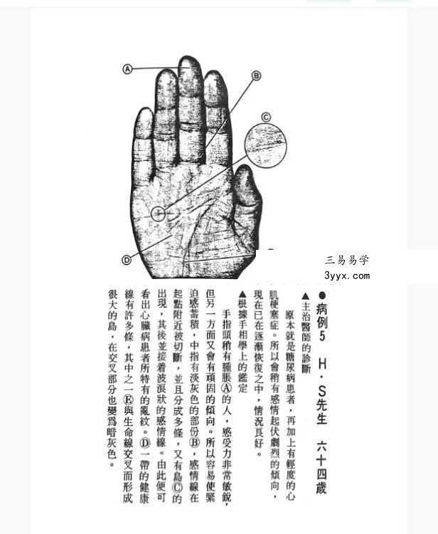 《由手相看健康》209页 资料图片