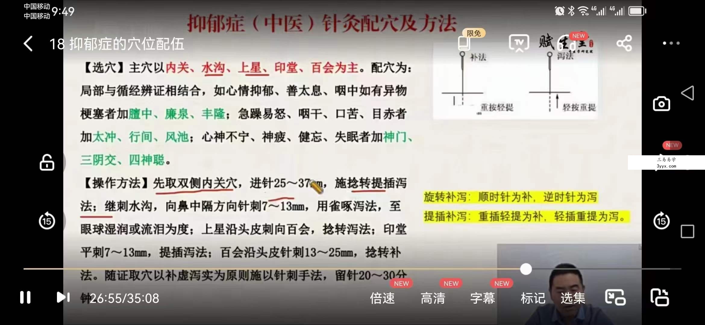 张振虎 道医鬼门十三针 24集 资料图片