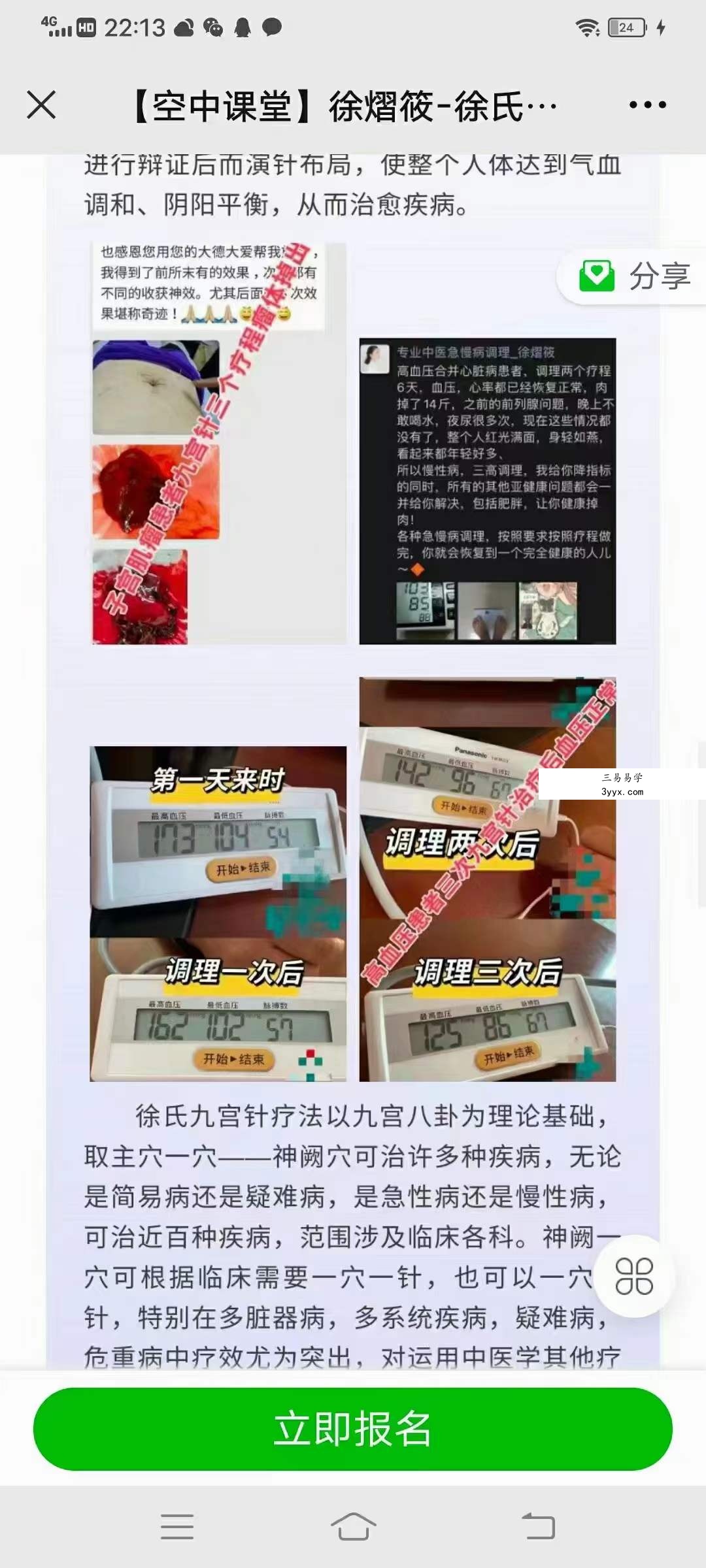 徐熠筱 九宫针疗法临床技术 资料图片